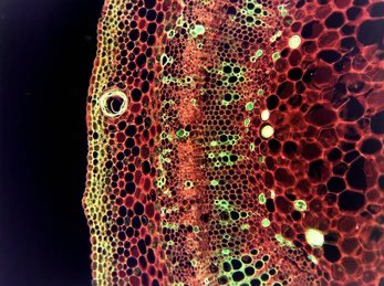 显微镜下的西瓜细胞 图源：microscopic images