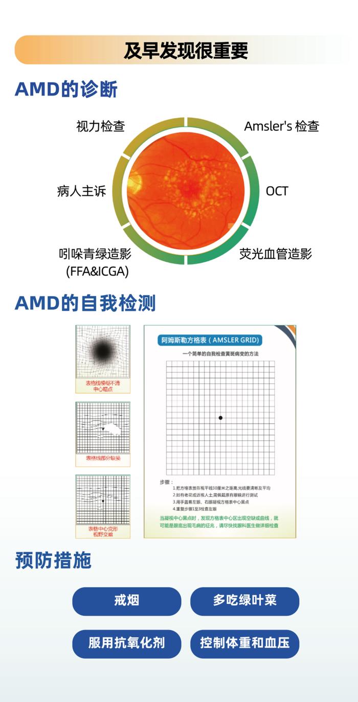 老年黄斑变性如何预防?医生:这四点要记住