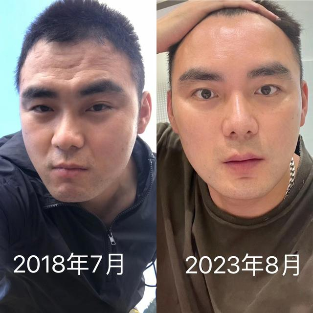 "护肤"与"不护肤"的中年男人,差别有多大?看这3组对比就懂