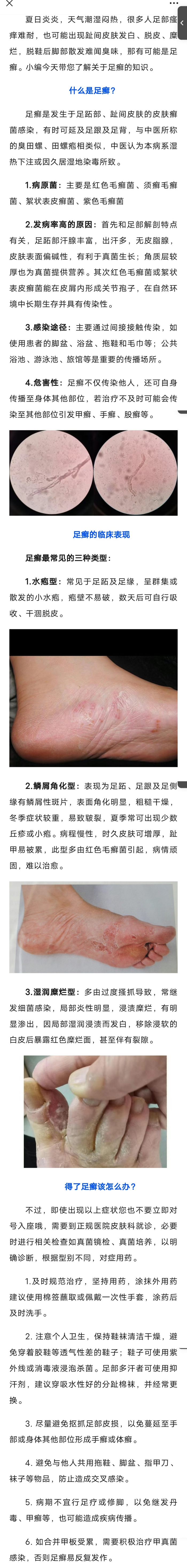 夏日炎炎,您的脚丫还好吗?