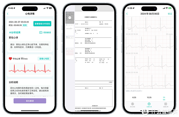 心电图仪器怎么充电30岁以下发病率超15.3%!心脑血管疾病找上门了?谈谈互联网诊疗背景下—乐普 ER1如何做心电管理_新闻资讯_第13张_活检穿刺产品网 心电图仪器怎么充电30岁以下发病率超15.3%!心脑血管疾病找上门了?谈谈互联网诊疗背景下—乐普 ER1如何做心电管理_https://www.jmylbn.com_新闻资讯_第13张