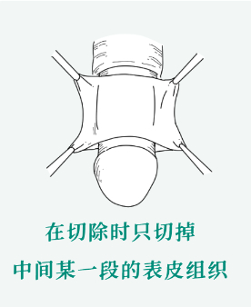 蛋蛋|手术_新浪新闻