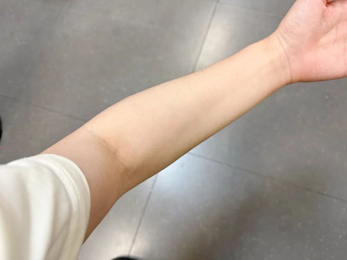 健康时报资料图