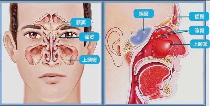 额窦气化图片