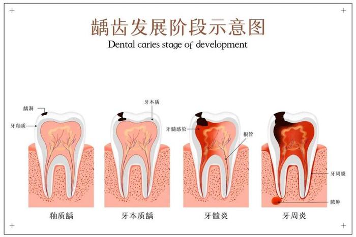 牙齿颊部的位置图片图片