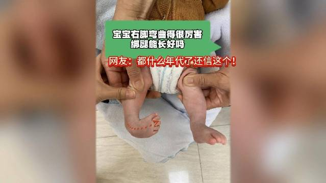 宝宝右脚弯曲得很厉害,绑腿能长好吗?网友:都什么年代了还信这个!
