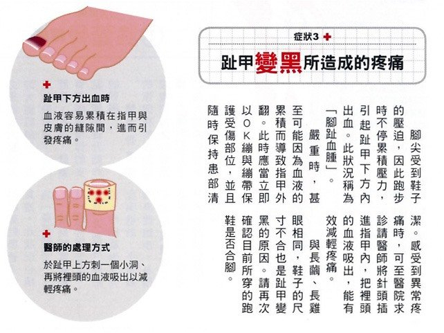 脚趾甲变黑