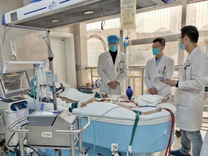 医生们正在救治一例重度烧伤患者