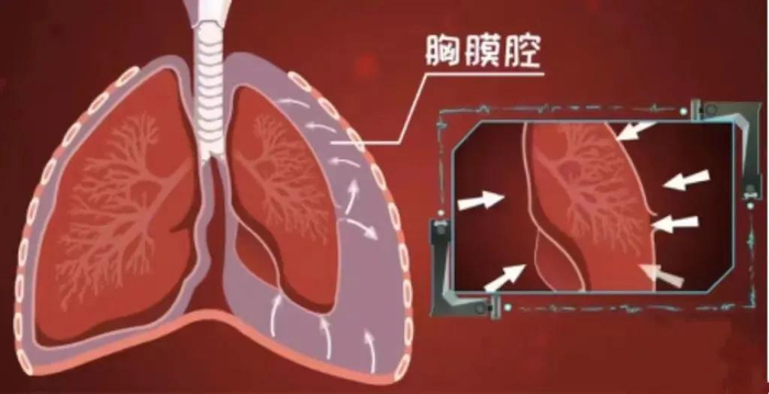 知名歌手时隔8年再回归！“消失这么久是因为生病”|方大同|气胸|胸腔_新浪新闻