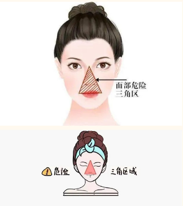 面部的"危险三角区"你知道吗?