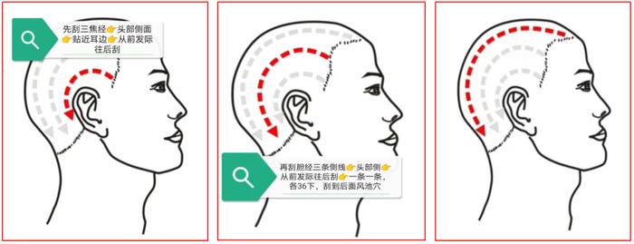 额头刮痧方向示意图图片