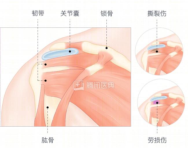 其实大部分不是