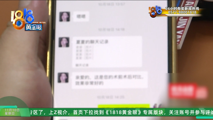 女子整容后肿得像外星人?她还提到了软禁、拖行、扇巴掌(图26)