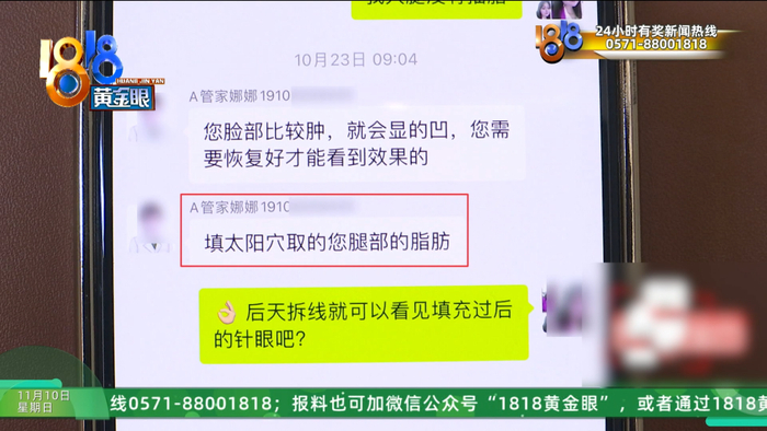 女子整容后肿得像外星人?她还提到了软禁、拖行、扇巴掌(图25)