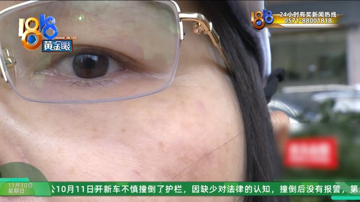 女子整容后肿得像外星人?她还提到了软禁、拖行、扇巴掌(图20)