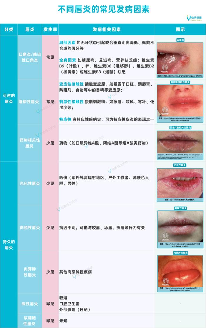 口角炎原因图片