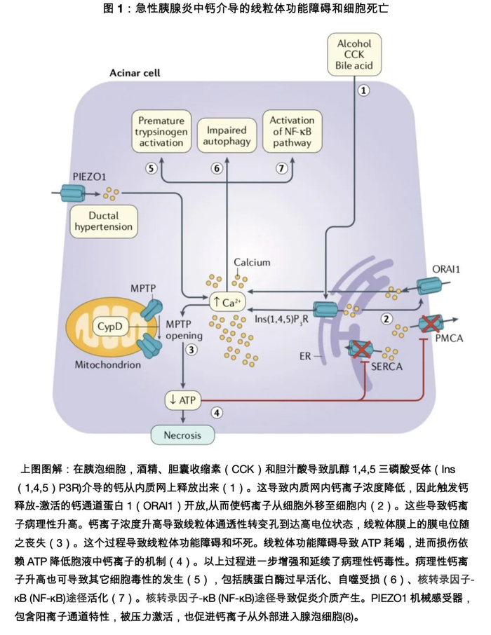 急性胰腺炎的新见解|肝病|胃肠道疾病|疫情|护士|海外华人生活_新浪新闻
