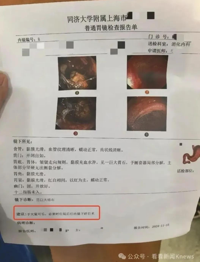 医生的医嘱写着“予大量可乐”，图源：看看新闻Knews