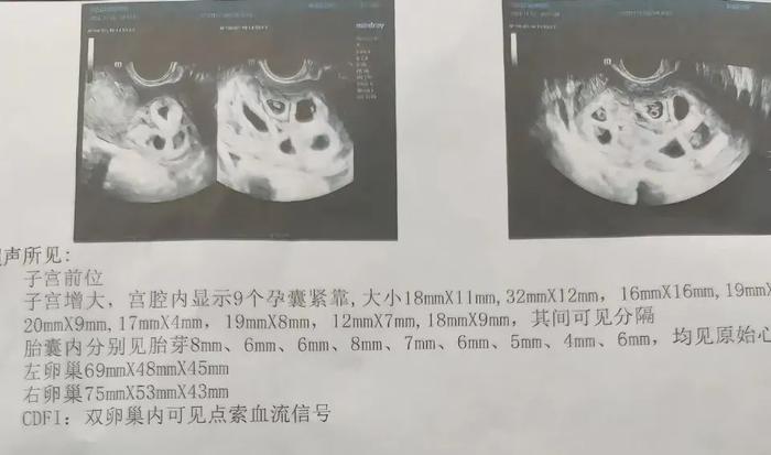 侯女士的检查单。来源：当事人社交媒体账号