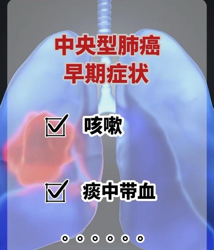 发病率和死亡率居癌症首位！但肺癌不是只有烟民才会得