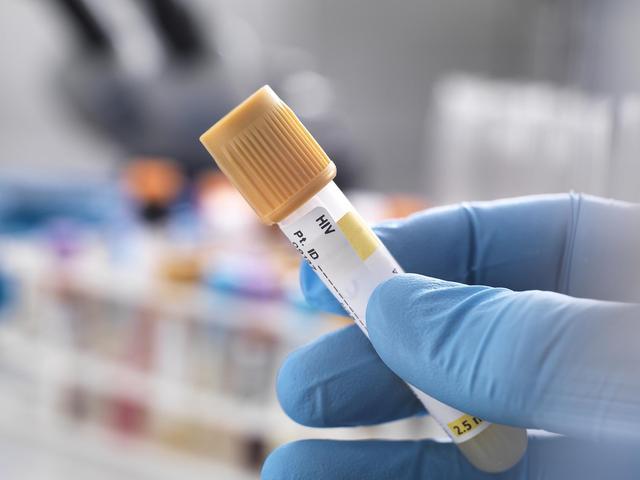 恐艾症咨询 _hiv医生在线咨询_ 艾滋病恐惧症人数 
