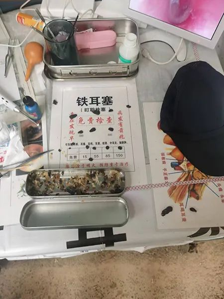 孔某的采耳摊  闵行公安供图