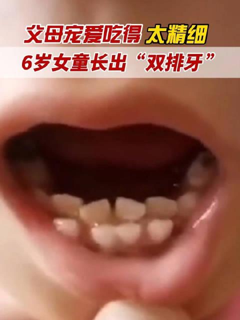 牙齿很长图片