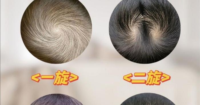 孩子头顶“旋”的个数不同代表什么？很多父母不懂，看完涨知识