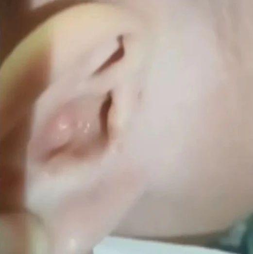 揪心！1岁半宝宝"脑脊液"从耳朵流出，只因模仿大人做了这个动作…