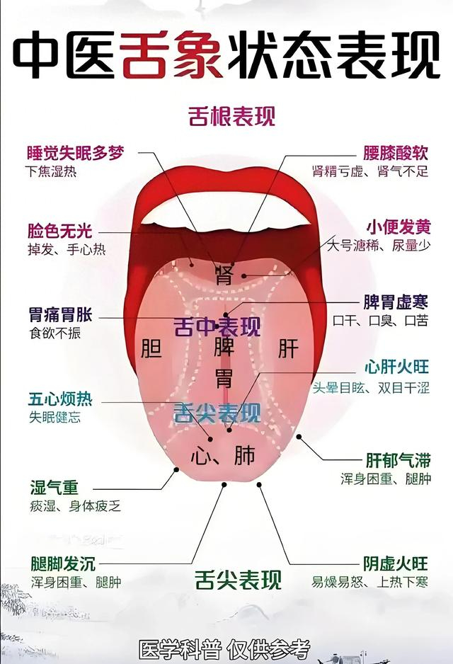 【中医学习】中医舌诊口诀大总结,太全啦!|舌苔|津液|舌裂|主凶|镜面_新浪新闻