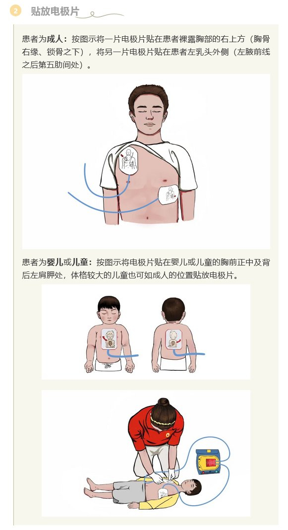 如何正确使用aed装置?
