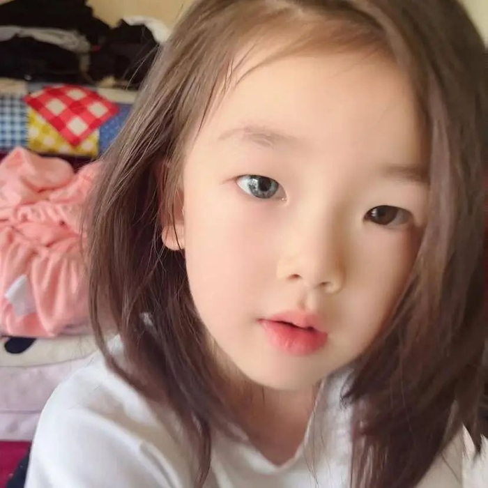 江西异瞳女孩（图据受访者）