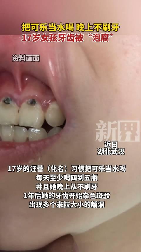 可乐牙能恢复吗图片