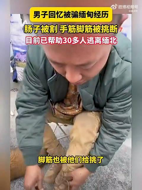 挑脚筋缅甸图片