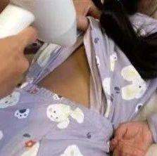 5岁男童因家人一个举动，深度烧伤险丧命，家家户户都有，不可乱用