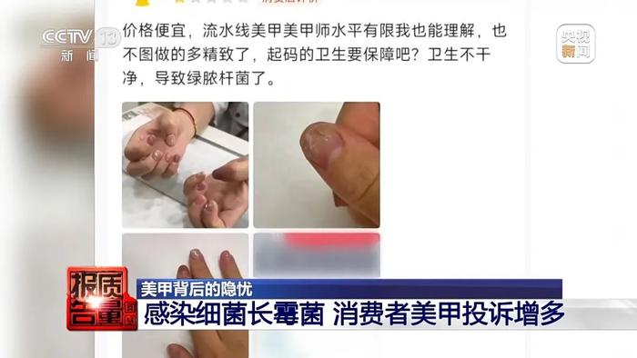 法制晚报：深夜福利院在线观看-做美甲染上了HPV病毒？揭露美甲变“毁甲”背后的隐忧  第12张