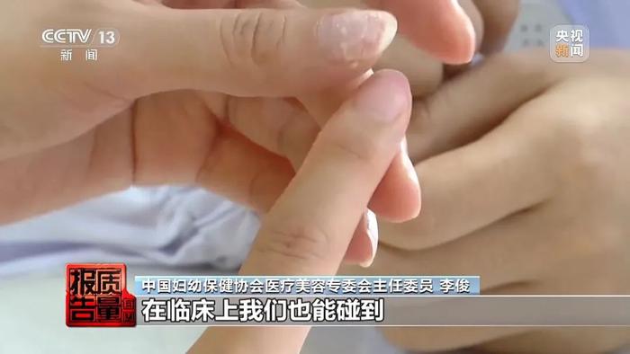 法制晚报：深夜福利院在线观看-做美甲染上了HPV病毒？揭露美甲变“毁甲”背后的隐忧  第16张