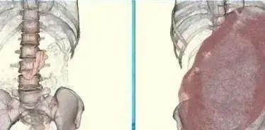 吃撑的胃有多大 图片来源：生命时报