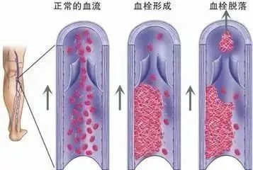 △图自深圳卫健委