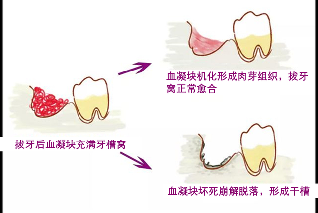 图源：南京市口腔医院