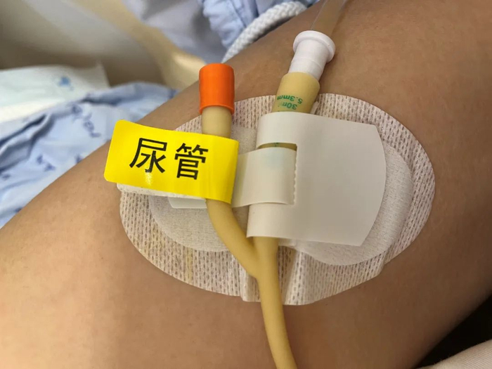 引流管怎么标识巧用色彩管理,让临床护理更出彩!_新闻资讯_第11张_活检穿刺产品网 引流管怎么标识巧用色彩管理,让临床护理更出彩!_https://www.jmylbn.com_新闻资讯_第11张