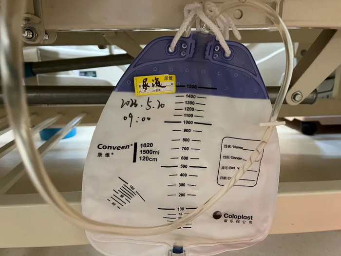 引流管怎么标识巧用色彩管理,让临床护理更出彩!_新闻资讯_第14张_活检穿刺产品网 引流管怎么标识巧用色彩管理,让临床护理更出彩!_https://www.jmylbn.com_新闻资讯_第14张