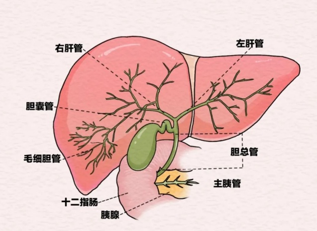 根据结石位置,胆结石可分为胆囊结石与胆管结石,大家常说的胆结石