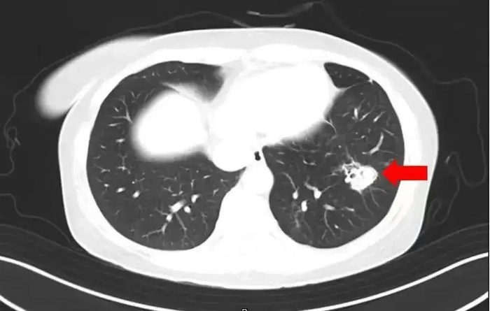 图源：健康杭州