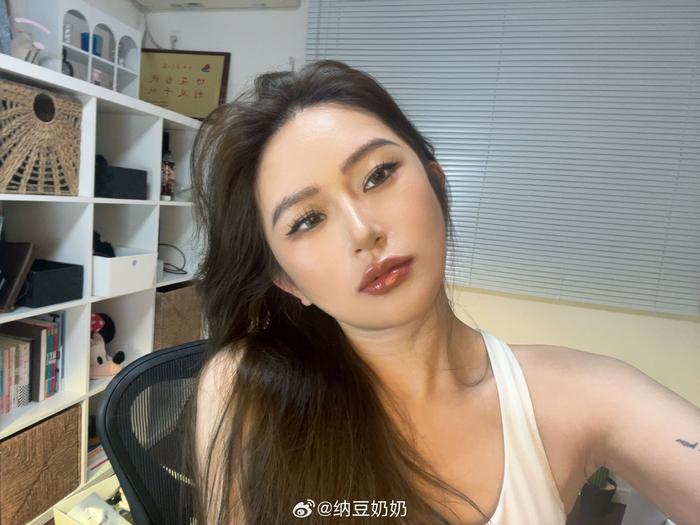 此博名为《植发一年请大家从各个角度观察我的发际线》