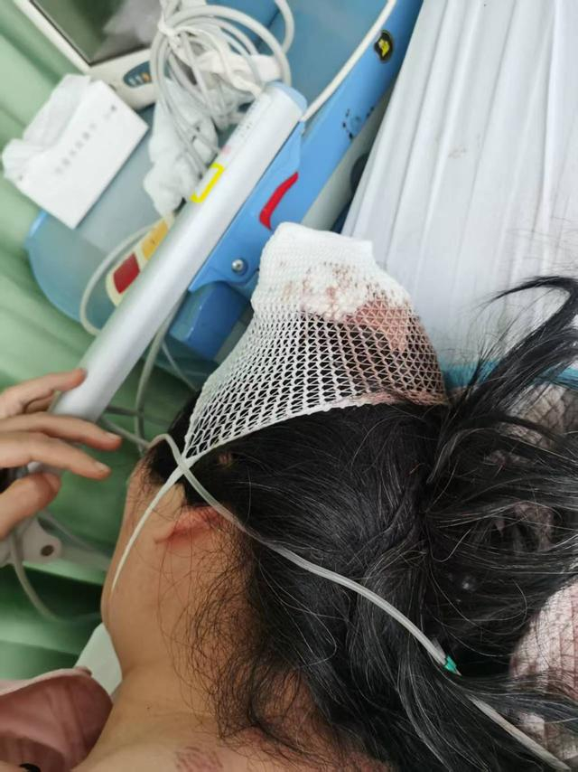 胡先生的妻子头部被砍伤 来源：受访者提供