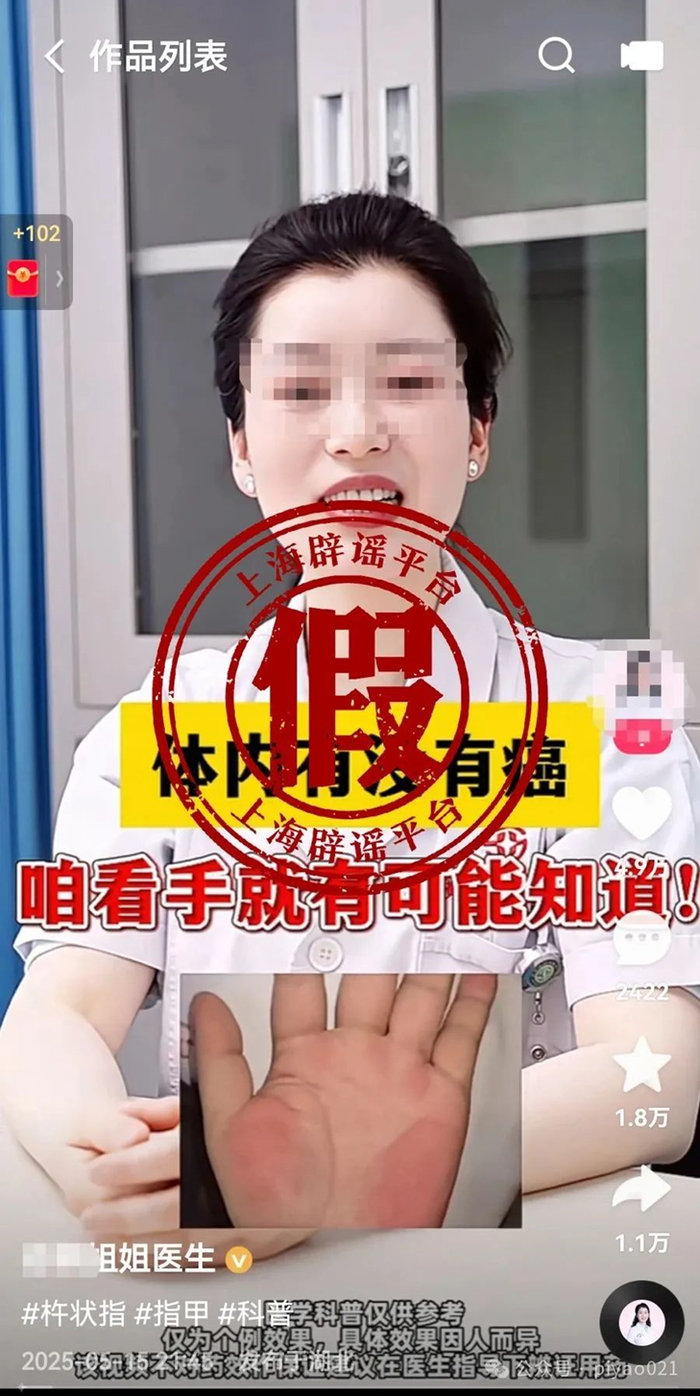 某三甲医院皮肤科医生发布“体内有没有癌，看手就知道”的视频。  来源：上海网络辟谣
