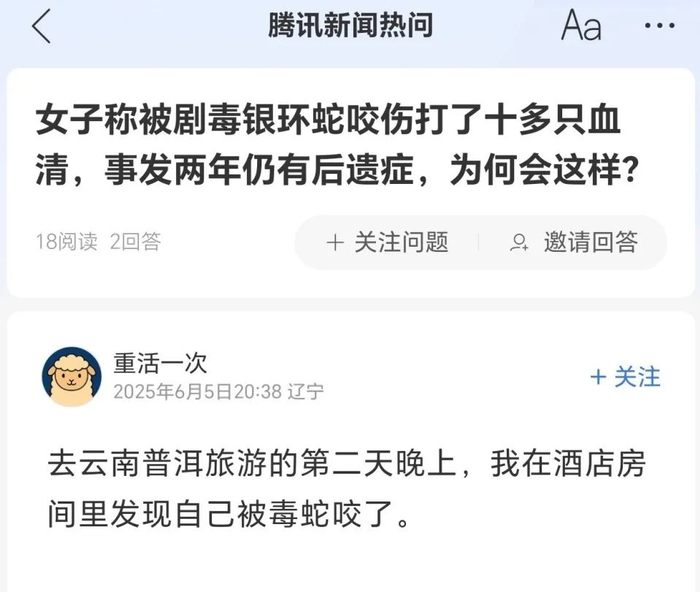 女子自述被蛇咬。图/腾讯新闻热问截图