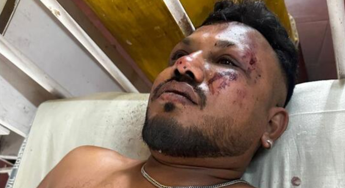 ▲幸存者维什瓦什在医院接受治疗