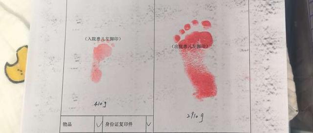 安安出入院脚印对比。河北医大一院供图